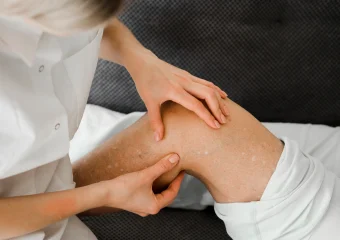 Ilustración de huesos con osteoporosis junto a alimentos ricos en calcio y una persona haciendo ejercicio para prevenirla