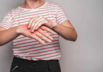 Imagen de una muñeca con un quiste sinovial visible, ilustrando la ubicación y apariencia típica de esta afección.