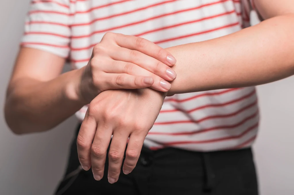 Ilustración de una mano con tendinitis de Quervain mostrando la zona afectada en la muñeca y el pulgar.